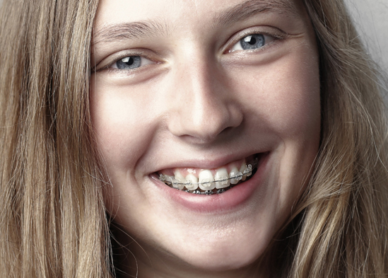 Orthodontic Treatments